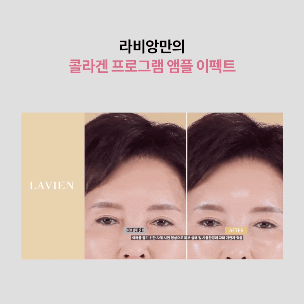 [매니아패키지] 화이트콜라겐 프로그램 16주+1주일분체험분